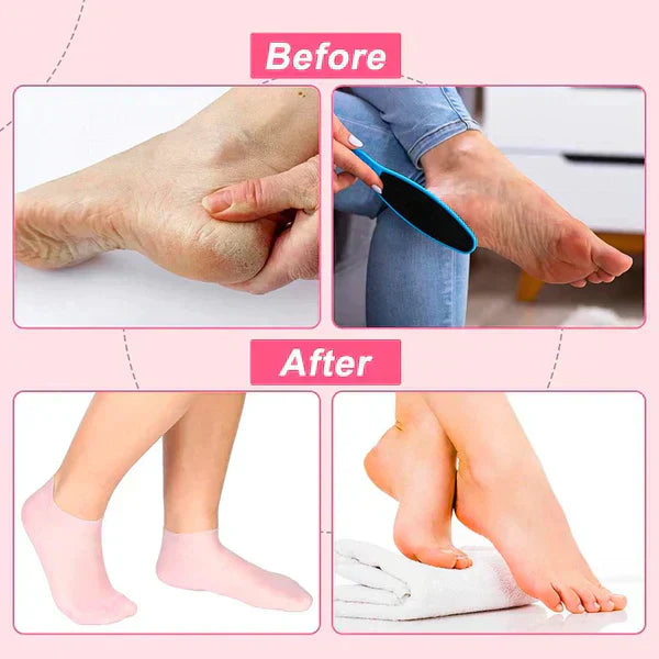 Silicone Socks